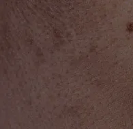 1 1